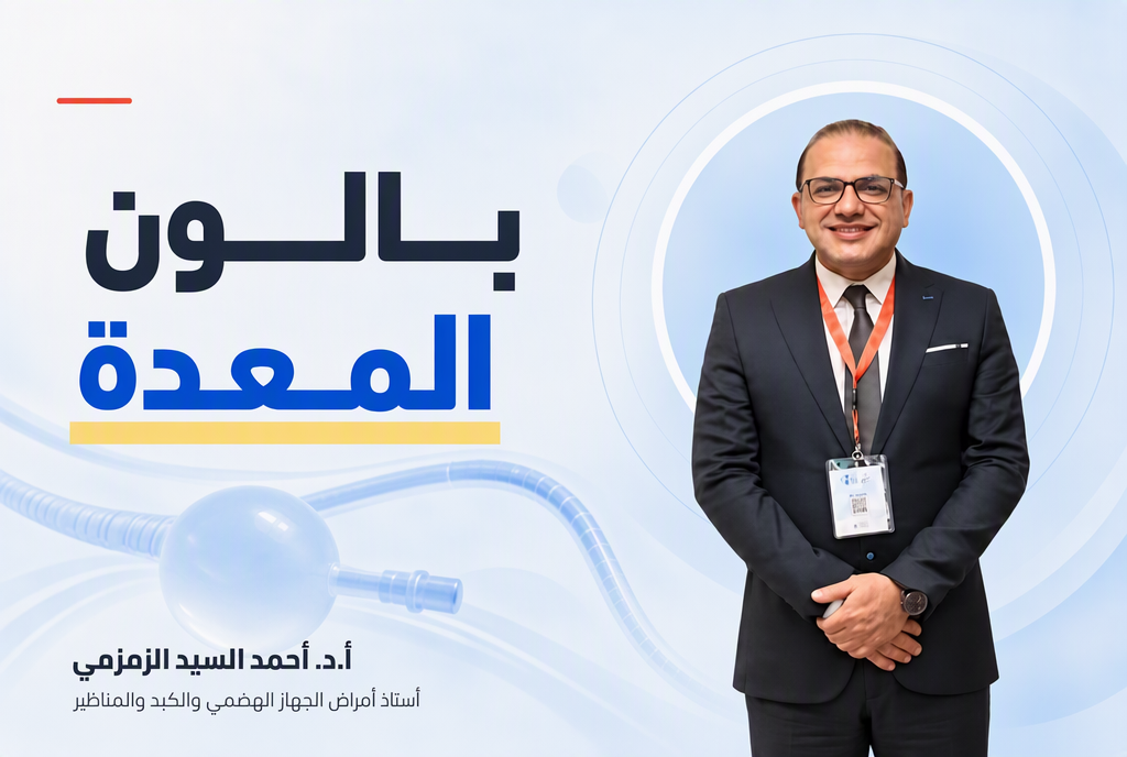 بالون المعدة