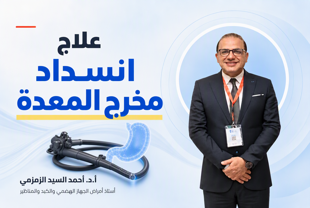 علاج انسداد مخرج المعدة