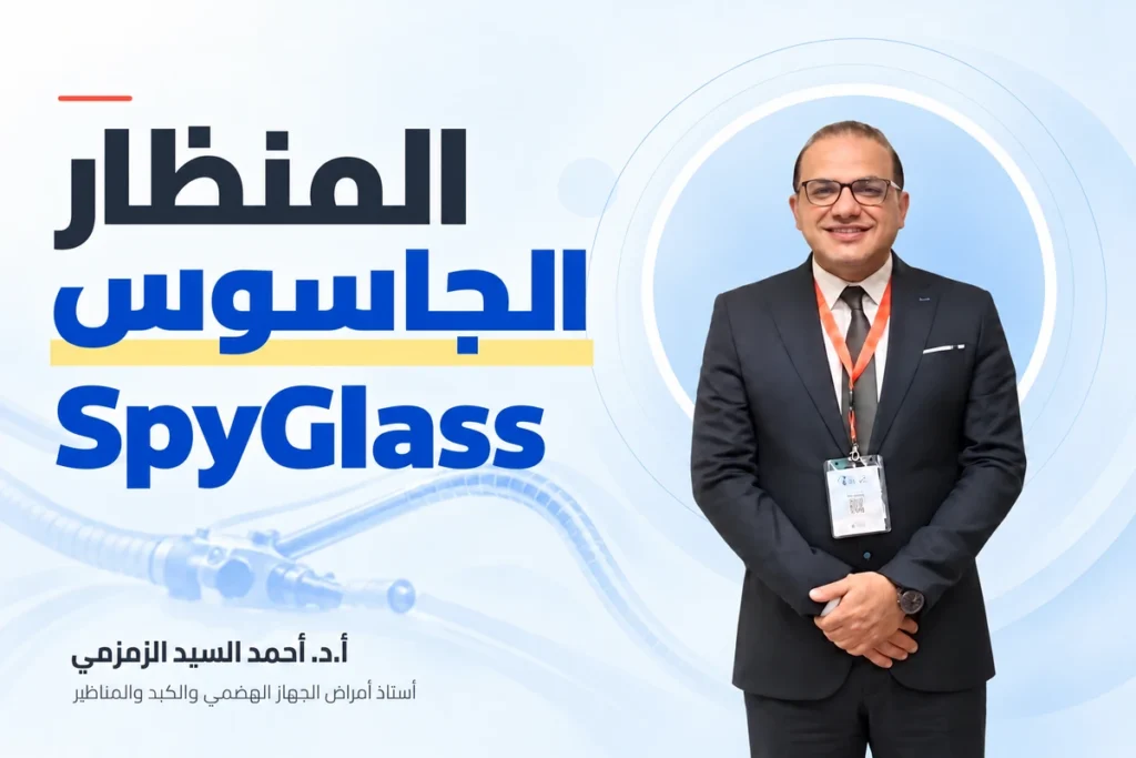 المنظار الجاسوس SpyGlass