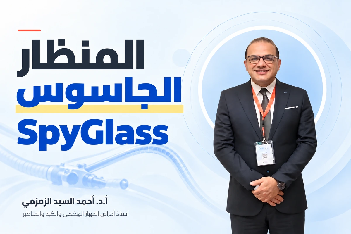 المنظار الجاسوس SpyGlass